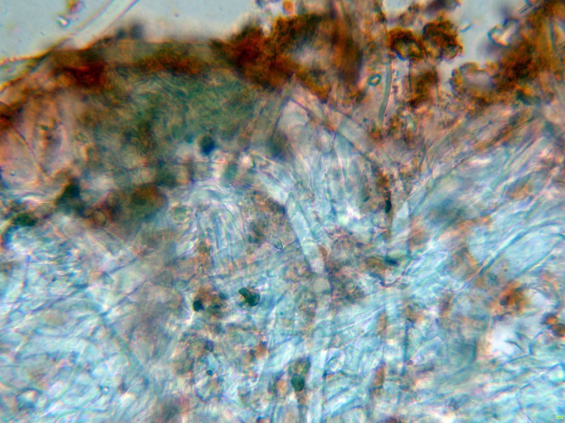 Microscopía de Stereum sanguinolentum - 10 - Cistidios-002